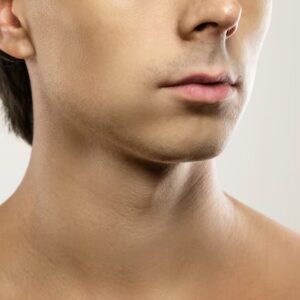 Acne Scars / Stretch Marks / Melasma / Wrinkles