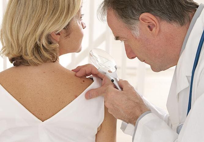 A doctor examines a skin mole on a patient's shoulder.