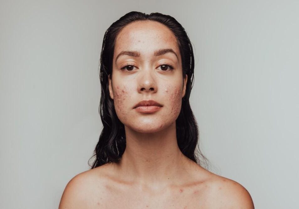 Portrait of a woman with wet hair against a plain background.