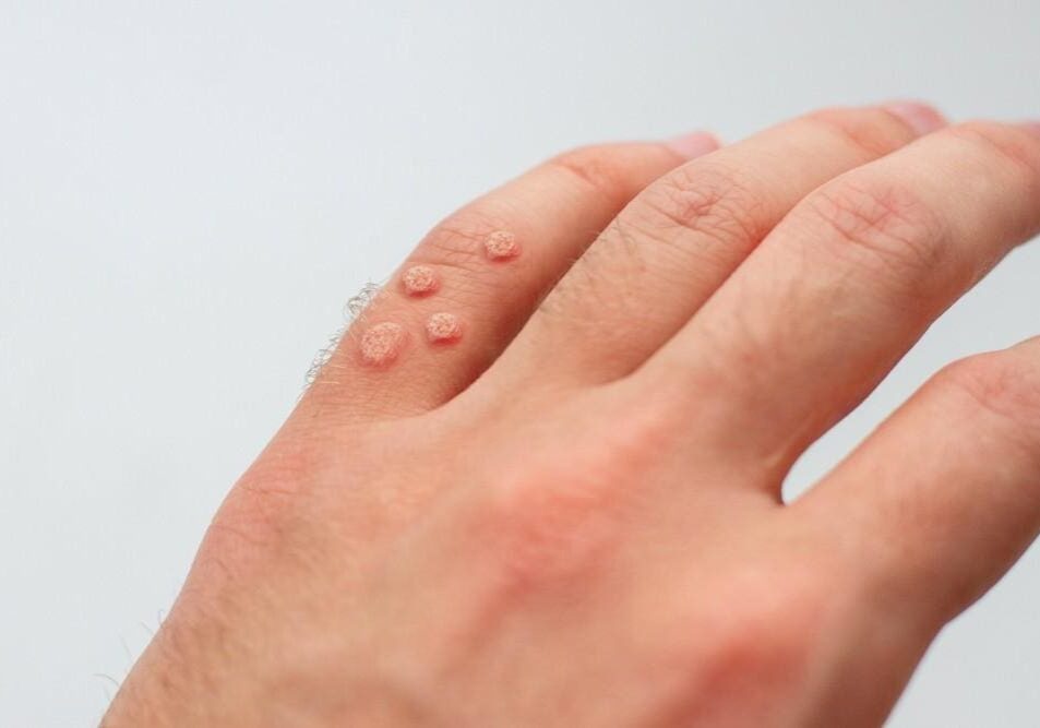 Close-up of a hand with small water droplets on the skin.