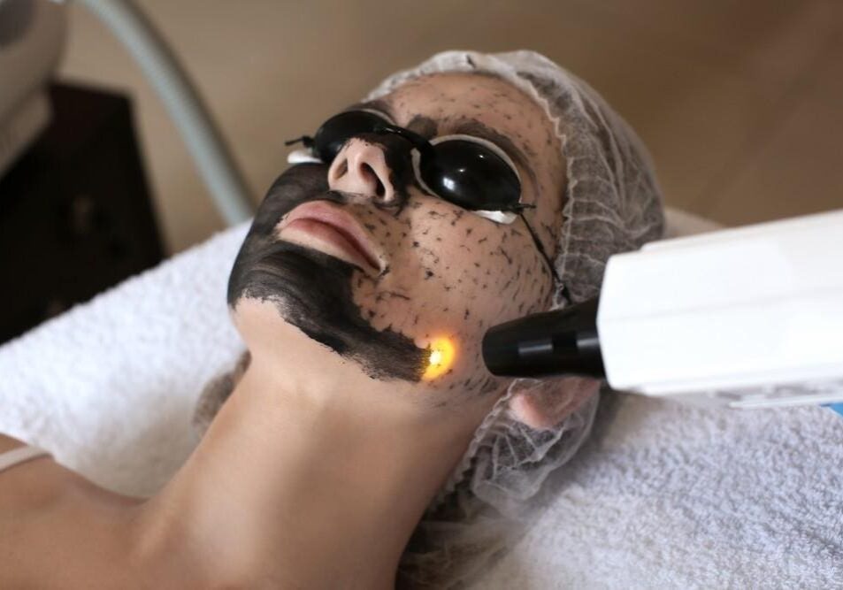 Woman undergoing facial laser treatment with protective eyewear.