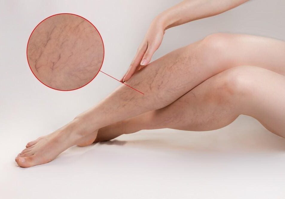 Person using a waxing strip to remove hair from their leg.