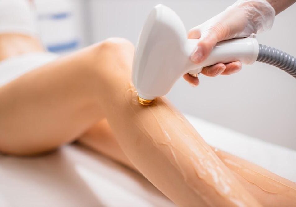 Laser hair removal being performed on a person's leg.